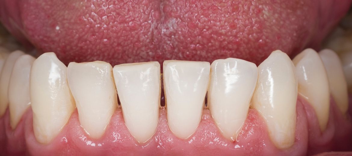 General Dentistry