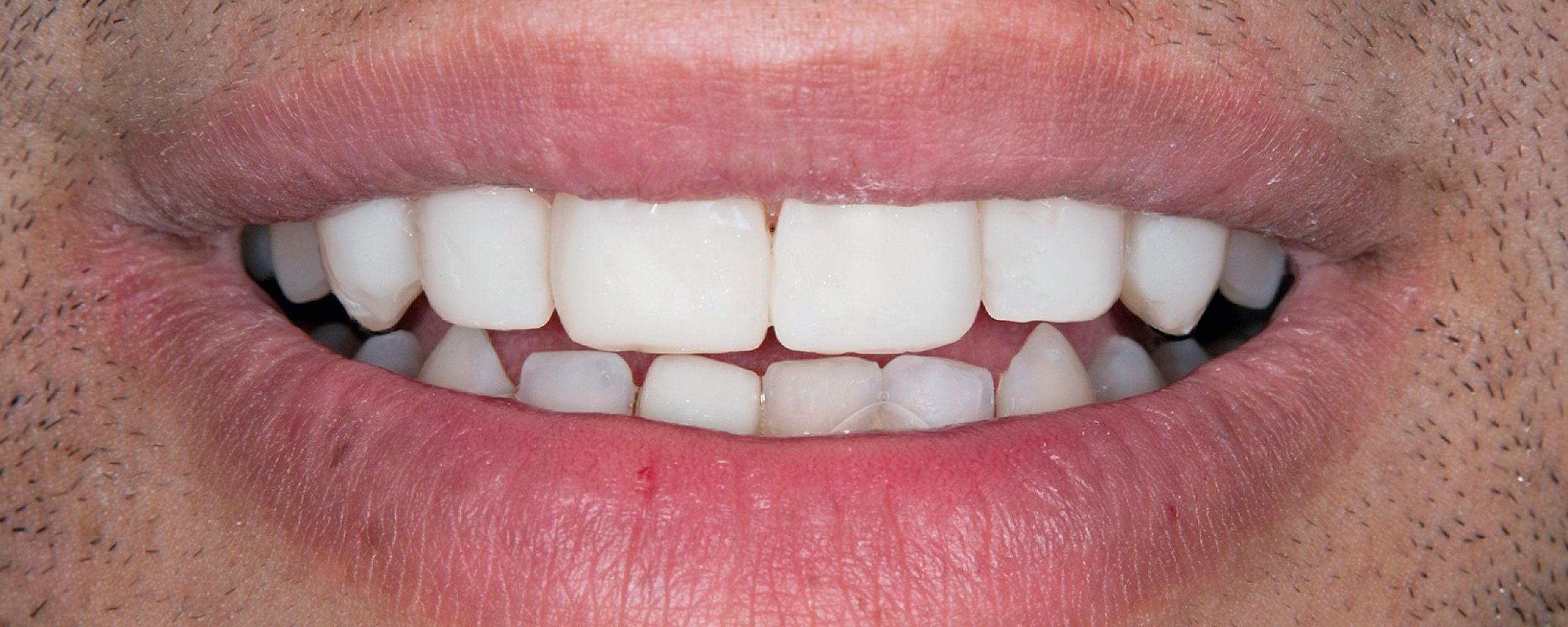 Emergency Dentistry