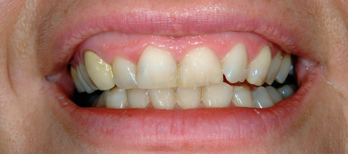 Emergency Dentistry